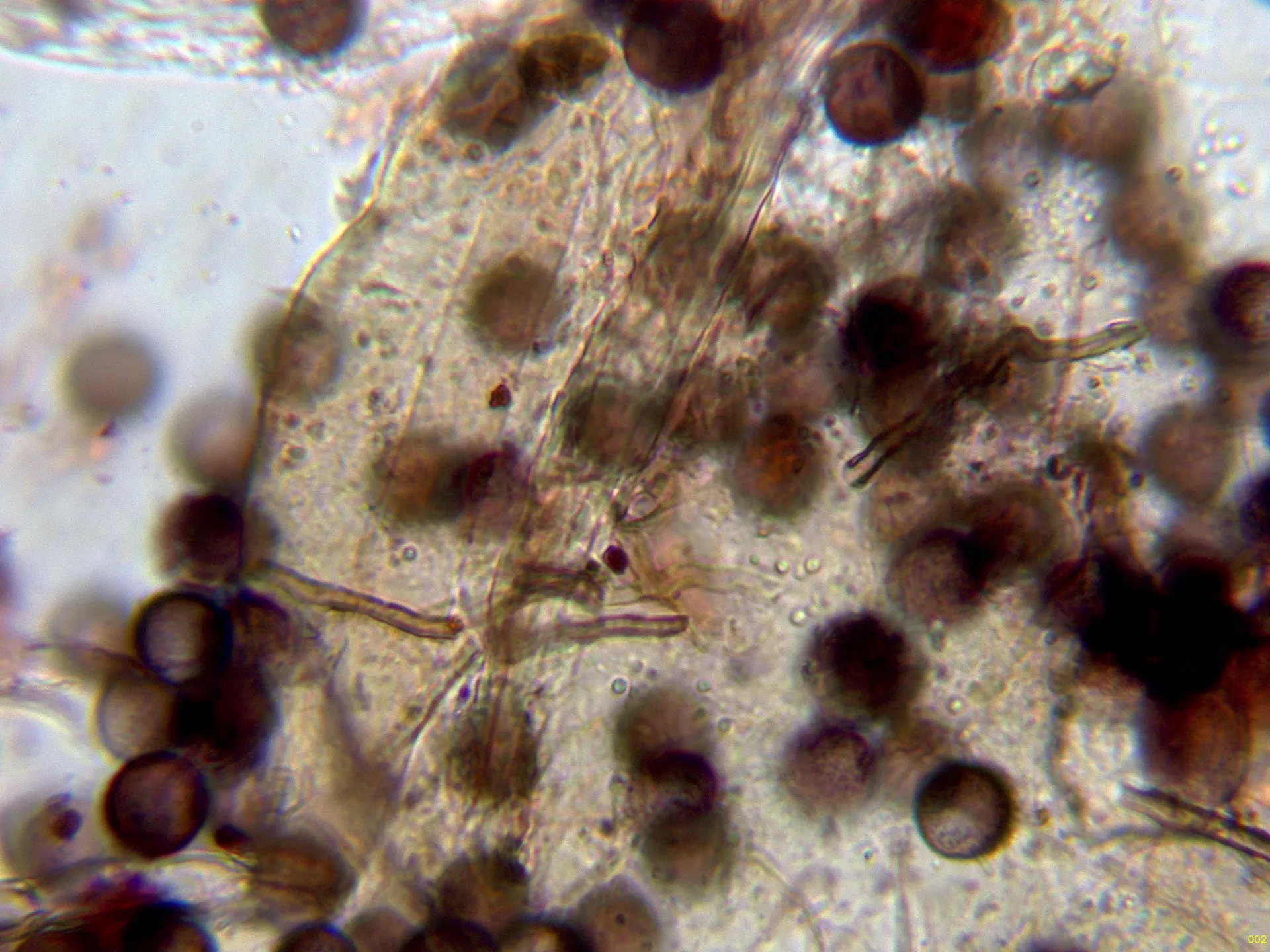 Microscopía de Physarum newtonii - 13 - Membrana-002